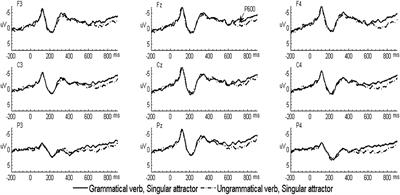 An ERP Study on Attraction Effects in Advanced L2 Learners